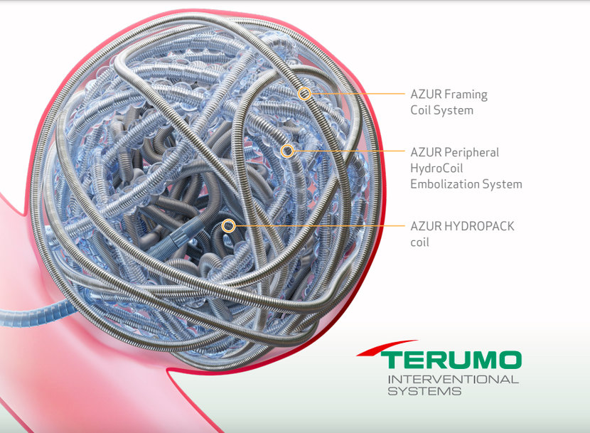 TERUMO LAUNCHES NEW AZUR HYDROPACK™ PERIPHERAL COIL SYSTEM